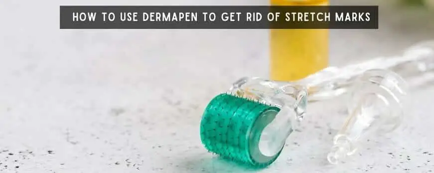 How to Use Dermapen to Get Rid of Stretch Marks